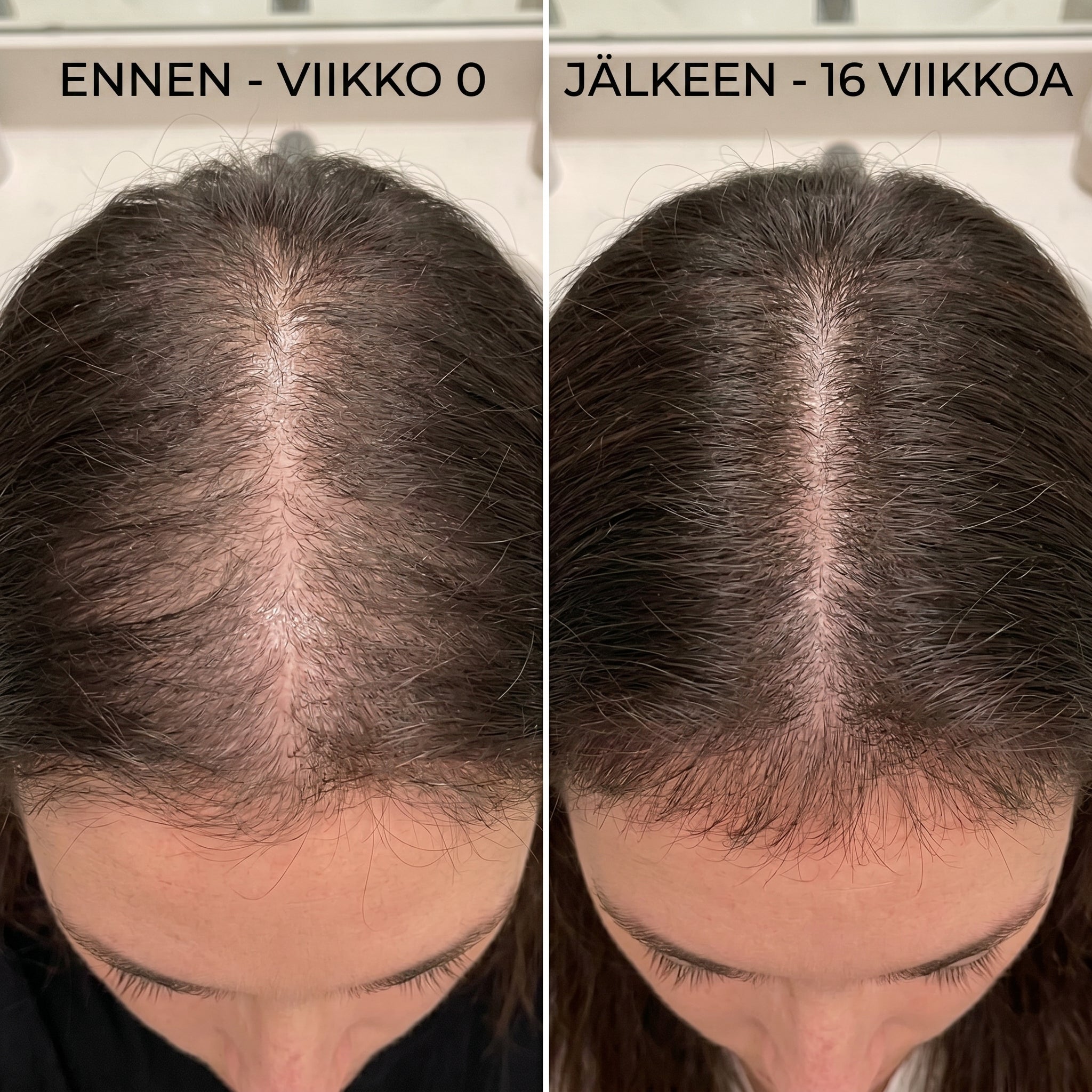 PRACTS Kurpitsansiemenöljy Pehmytkapselit