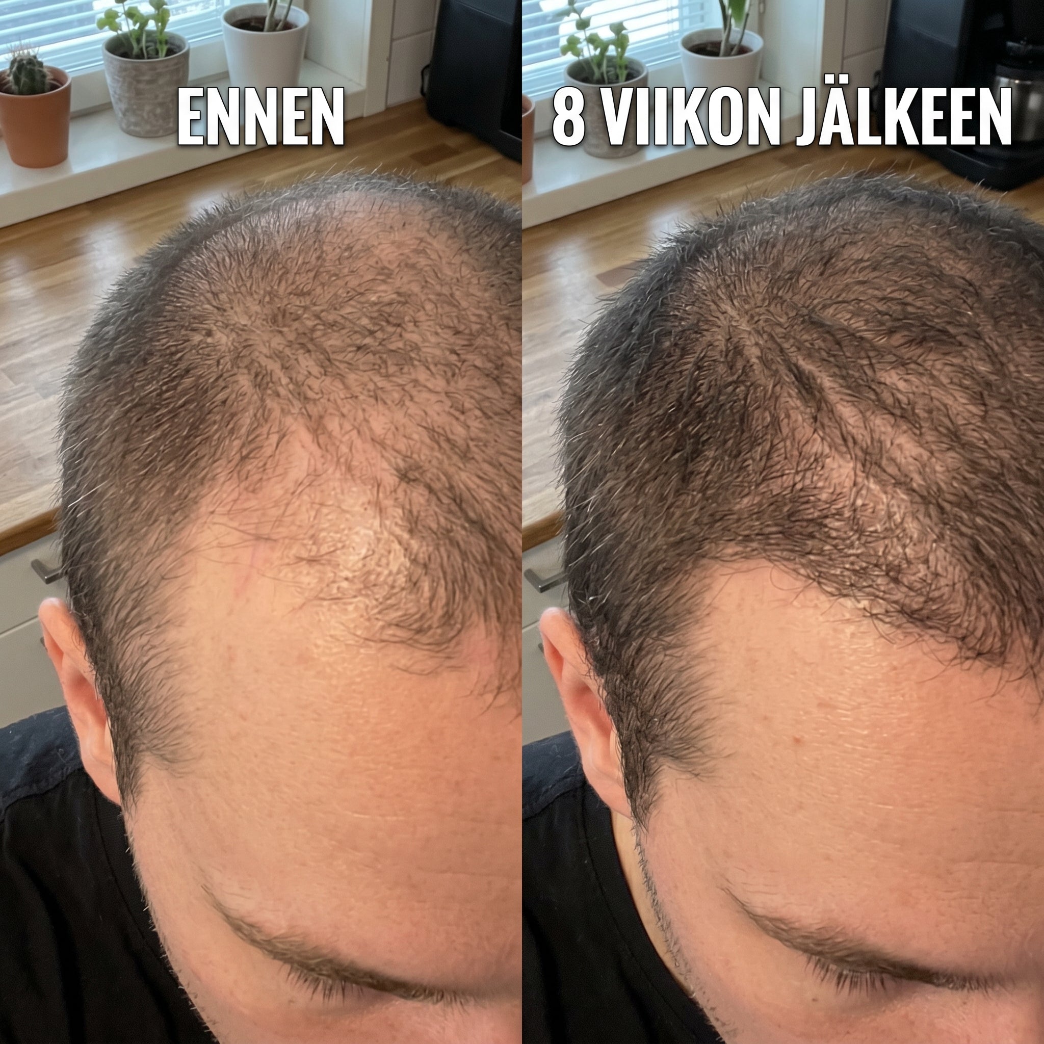 PRACTS Kurpitsansiemenöljy Pehmytkapselit